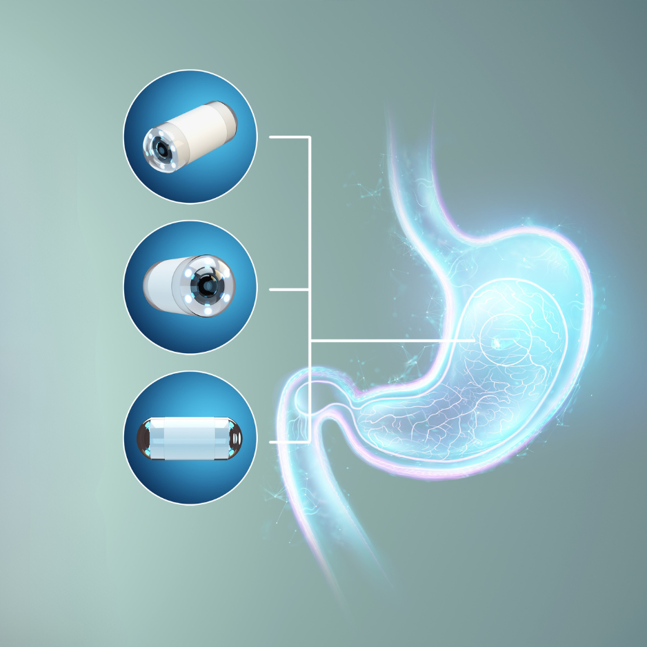 Cápsula Endoscópica - Estudio mínimamente invasivo