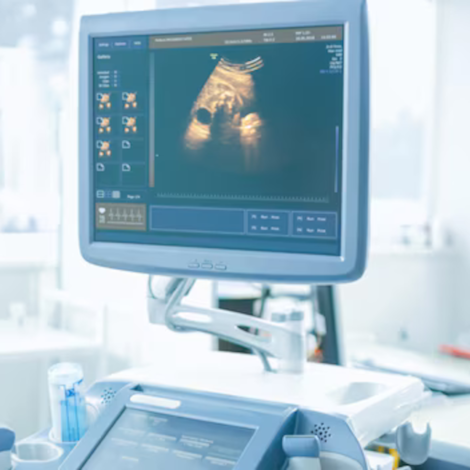 Ecografía Abdominal - Diagnóstico por imagen