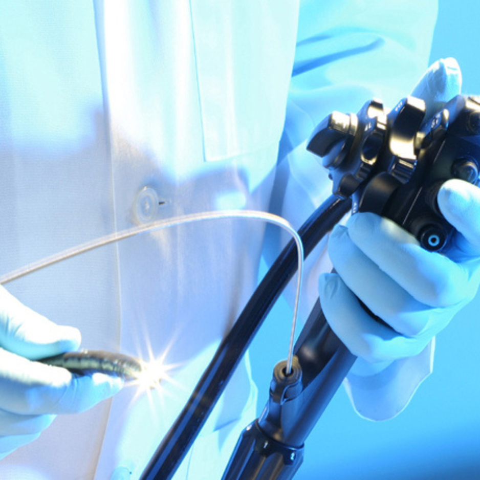 Gastroscopia - Prueba endoscópica alta